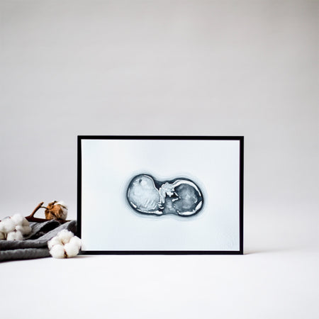 cotton stories sonogram art